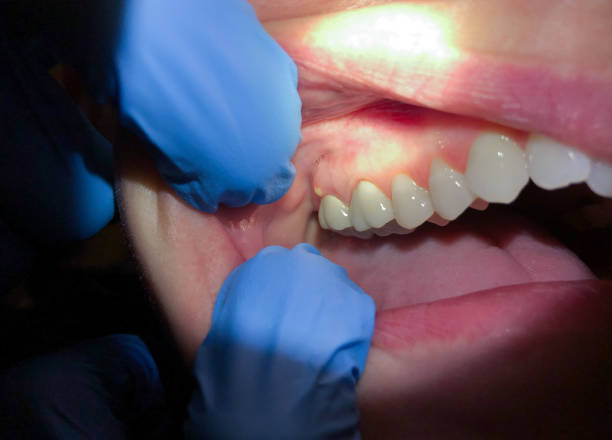 Professional Emergency Dental Service in NC